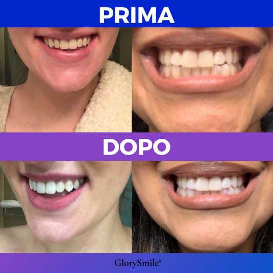 Siero GlorySmile Italia - 2  minuti al giorno per un sorriso più bianco, sano e luminoso